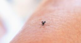 Close-up image of a mosquito on human skin, representing malaria detection and mosquito-borne disease monitoring.